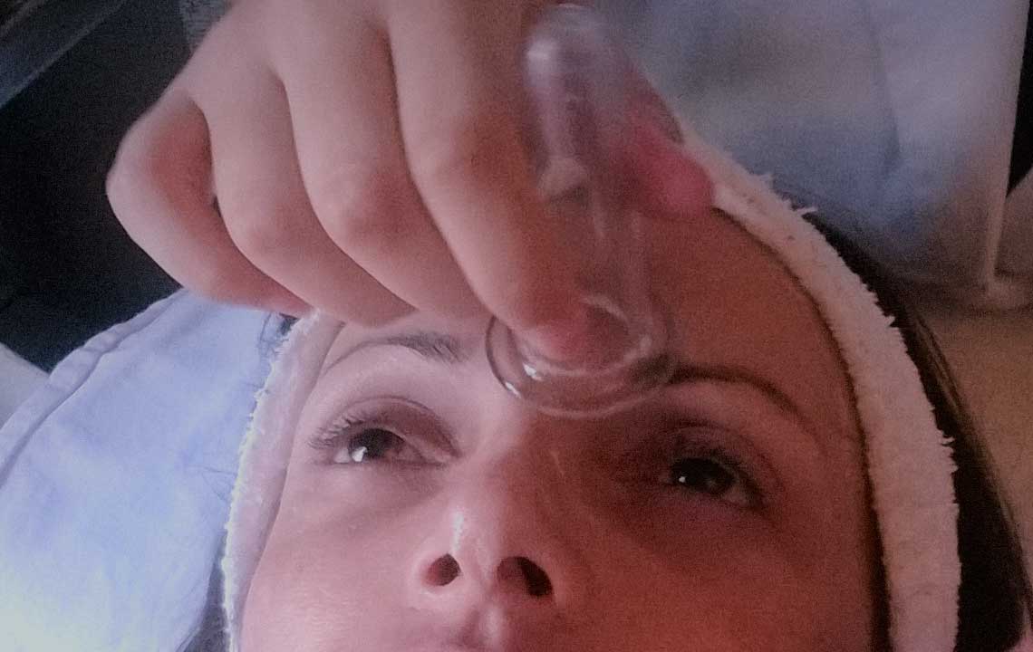 fecial cupping